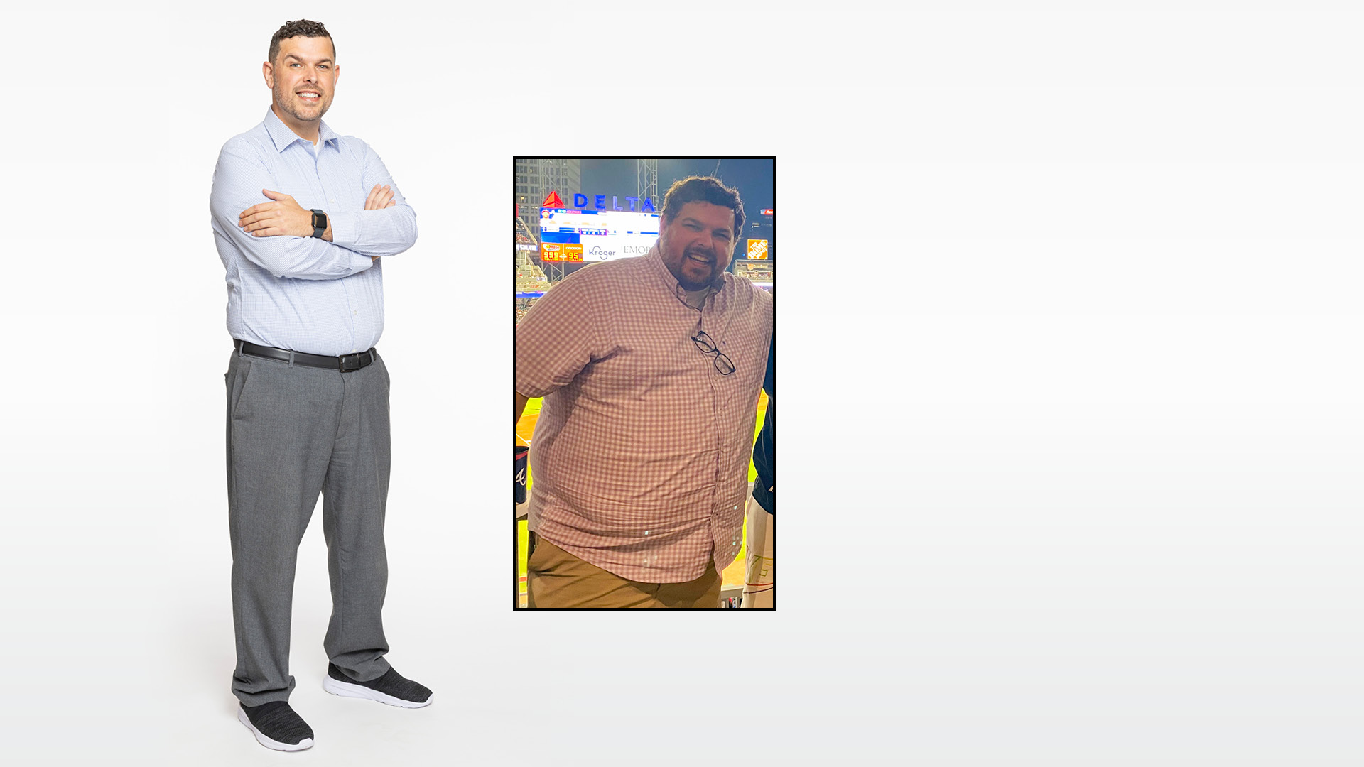 Jason, surgical weight loss patient