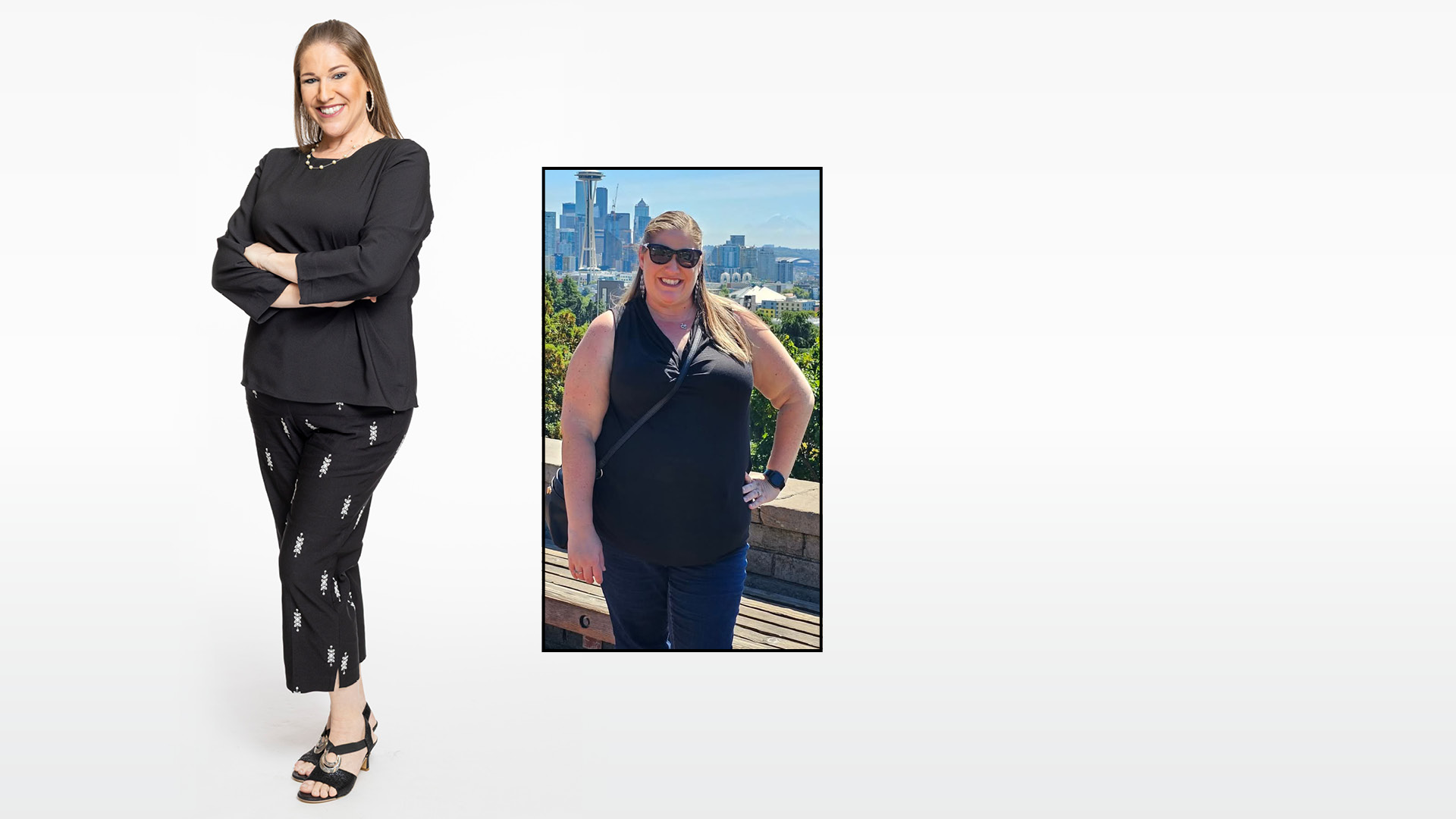 Lacey, surgical weight loss patient